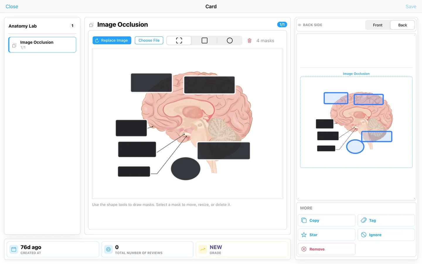 Image occlusion editor with multiple masks over an anatomy diagram