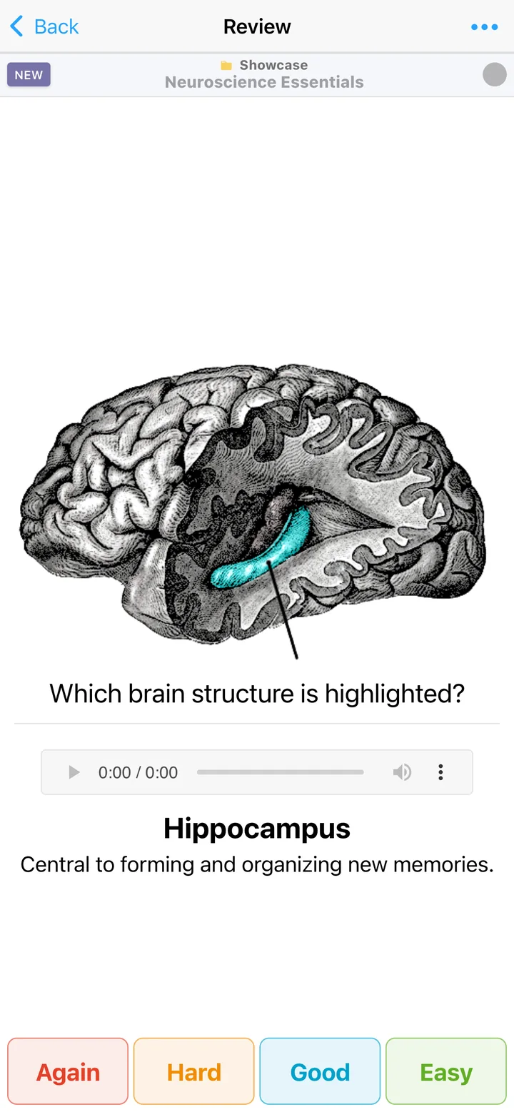 Multimedia neuroscience card with a brain image and audio